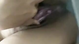 Perawat Cantik Pamer Memek Pesingnya
