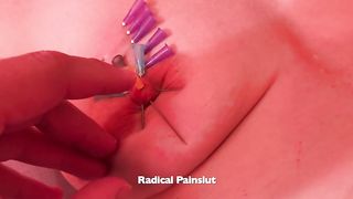 BDSM EXTREME NEEDLE TORTURE TITS, NIPPLES & PUSSY FOR SUBMISSIVE PAINSLUT