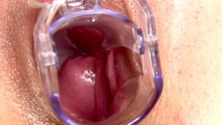 A serious vaginal intake of a diverse selection of toys and tools