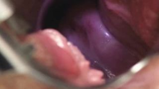 Amateur milf nurse naughty pussy stretching on gynochair