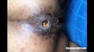 Hairy girl shitting an hard turd